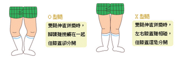 学步车的危害(为什么不建议买学步车)