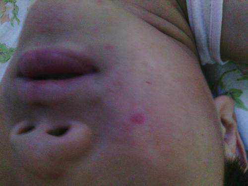 怎么区分是不是出水痘(怎么知道是不是出水痘)