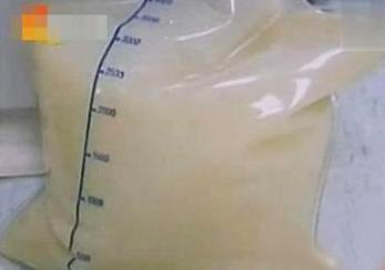 乳糜血是什么意思