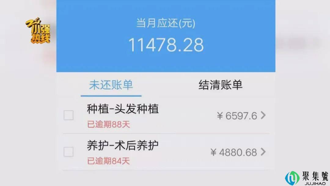 男子去植发,15元1根,付款时惊呆了:根本还不起……