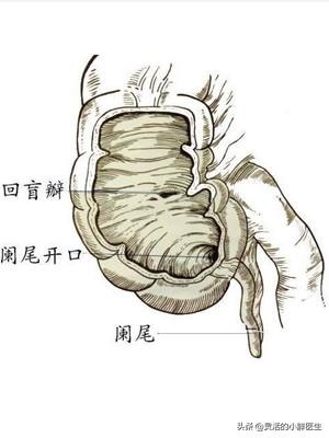 阑尾在哪个位置(阑尾在哪个位置图片)