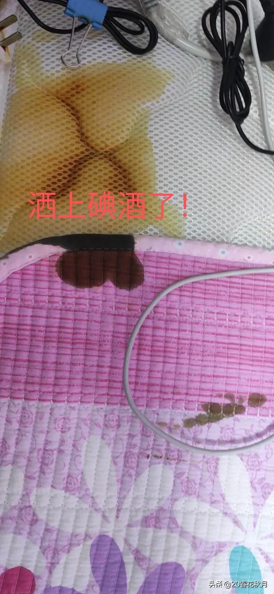 碘酒怎么洗掉最简单的方法(碘酒怎么洗掉)