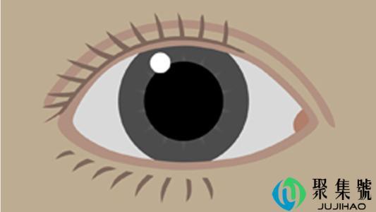 月牙眼和笑眼的区别