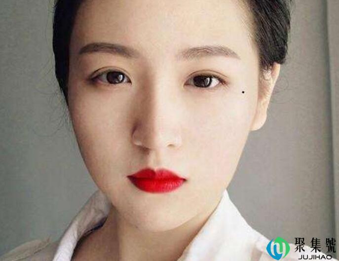 女生下面有痣什么意思