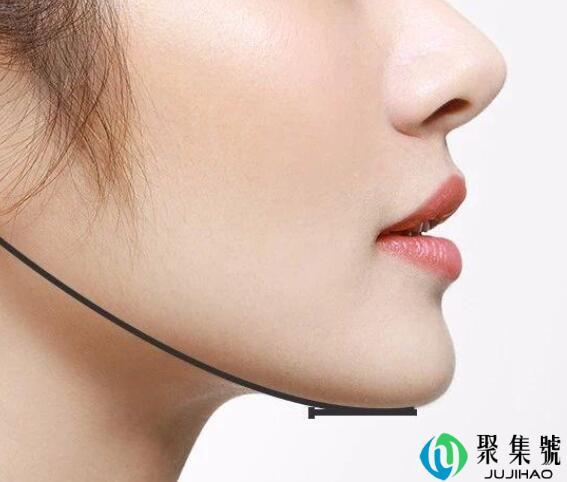 下颚线是什么意思