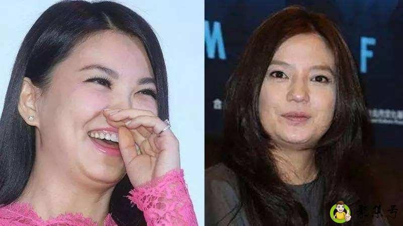 下颌线和下颚线的区别