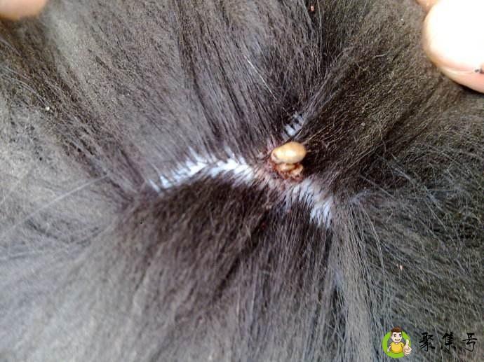 人体寄生虫有哪些种类