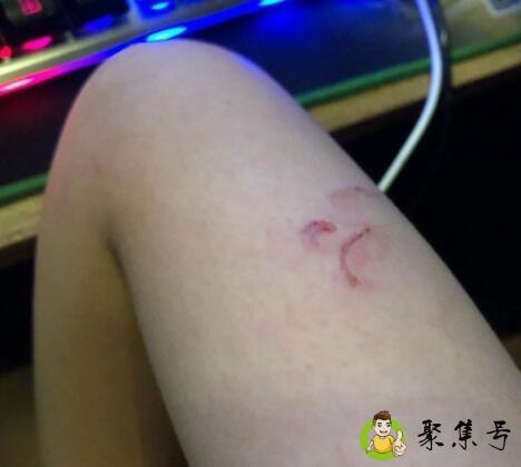 详细阅读:久伤豪的作用 久伤豪的作用