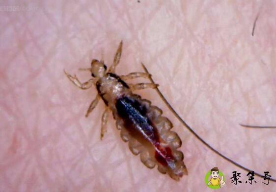 详细阅读:虱子怕什么味道 虱子怕什么味道