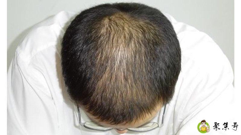 详细阅读:雄脱是什么意思 雄脱是什么意思