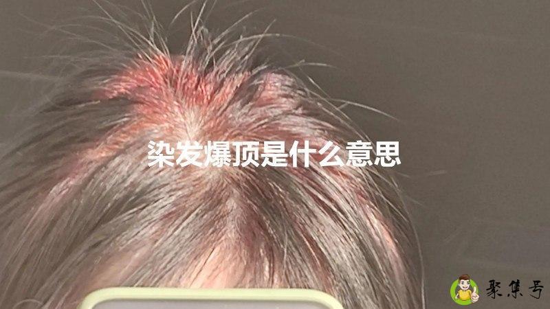 染发爆顶是什么意思