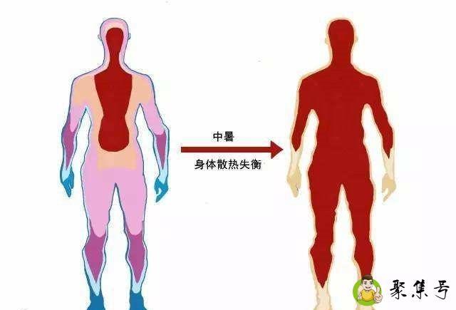 人体散热部位有哪四个