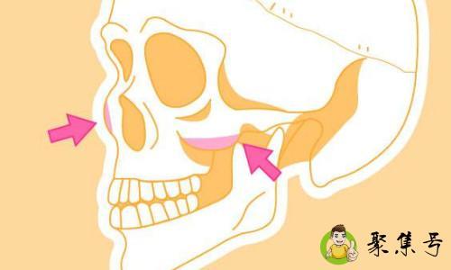 颊骨和颧骨的区别