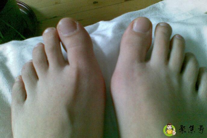 详细阅读:脚第二个脚趾长说法 脚第二个脚趾长说法