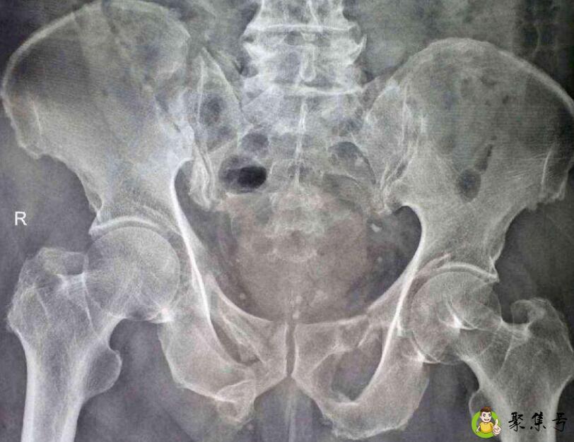 琵琶骨在哪个位置