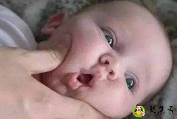 详细阅读:捏脸的危害 捏脸的危害