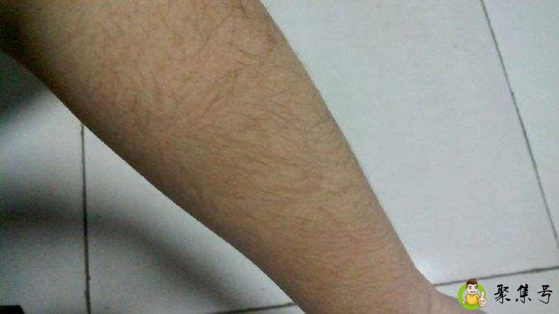 身上毛多意味着什么