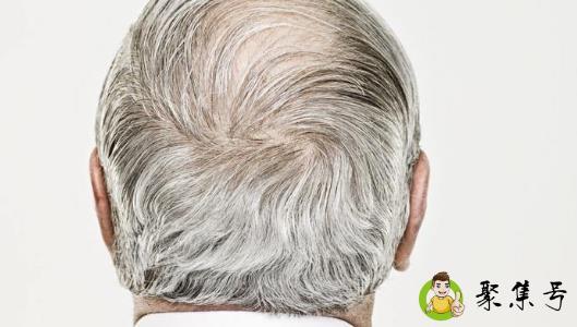 一夜白头是真的吗