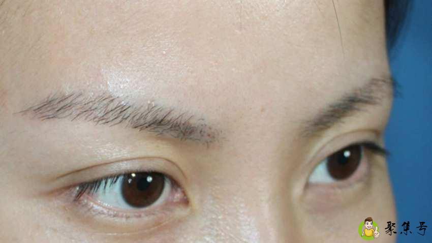 详细阅读:眉毛里长痘代表什么 眉毛里长痘代表什么